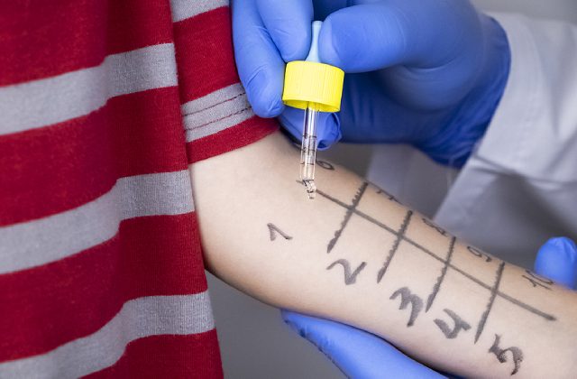 Paediatric Allergy Testing For Children: What to Expect