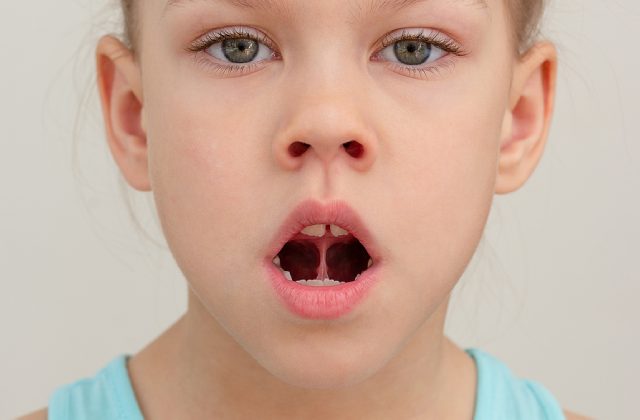 Sublingual Immunotherapy For Children With Respiratory Allergies